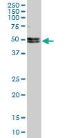 Anti-NOVA1 Mouse Monoclonal Antibody [clone: 5D9]