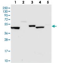 Anti-UAP1L1 Rabbit Polyclonal Antibody