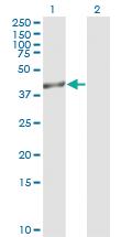 Anti-TRIB3 Mouse Monoclonal Antibody [clone: 2F7]