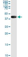 Anti-APEX1 Polyclonal Antibody Pair