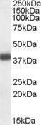 Anti-APOL2 antibody