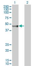 Anti-MVD Mouse Polyclonal Antibody