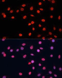 Immunofluorescence analysis of C6 cells using Anti-TLS / FUS Antibody (A9768) at a dilution of 1:100. DAPI was used to stain the cell nuclei (blue).