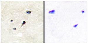 Immunohistochemical analysis of paraffin-embedded human brain using Anti-Synapsin1 (phospho Ser605) Antibody. The right hand panel represents a negative control, where the antibody was pre-incubated with the immunising peptide.