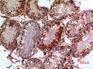 Immunohistochemical analysis of paraffin-embedded rat testis using Anti-PNPLA6 Antibody