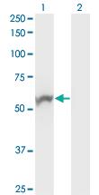 Anti-NOVA1 Mouse Monoclonal Antibody [clone: 3F7]