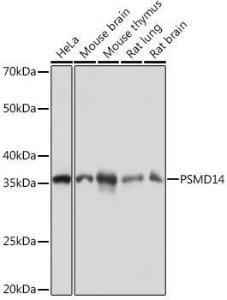 Anti-PSMD14 Rabbit Monoclonal Antibody [clone: ARC1655]