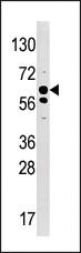 Anti-SYK Rabbit Polyclonal Antibody