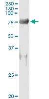 Anti-SNX9 Antibody Pair