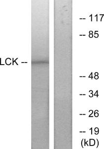 Western blot analysis of lysates from 293 cells, treated with serum 15% 10' using Anti-Lck Antibody. The right hand lane represents a negative control, where the antibody is blocked by the immunising peptide