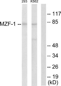 Western blot analysis of lysates from 293 and K562 cells using Anti-MZF-1 Antibody The right hand lane represents a negative control, where the antibody is blocked by the immunising peptide