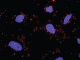 Anti-HDAC2 + CDH1 Antibody Pair