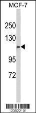 Anti-CXorf22 Rabbit Polyclonal Antibody (Biotin)