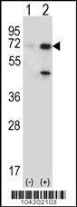 Anti-USP2 Rabbit Polyclonal Antibody (FITC (Fluorescein Isothiocyanate))