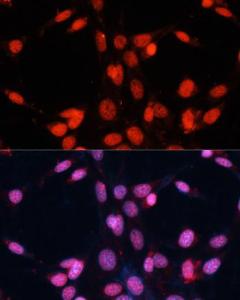 Immunofluorescence analysis of NIH/3T3 cells using Anti-TLS / FUS Antibody (A9768) at a dilution of 1:100. DAPI was used to stain the cell nuclei (blue).