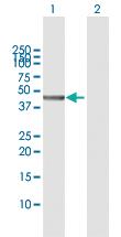 Anti-MVD Rabbit Polyclonal Antibody