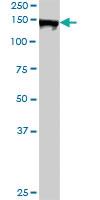 Anti-AFF4 Rabbit Polyclonal Antibody