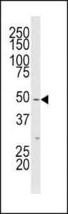 Anti-MLKLAK Rabbit Polyclonal Antibody (AP (Alkaline Phosphatase))