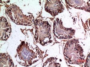 Immunohistochemical analysis of paraffin-embedded rat testis using Anti-PNPLA6 Antibody