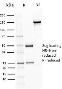 SDS-PAGE analysis of Anti-BOB1 Antibody [BOB1/2421] under non-reduced and reduced conditions; showing intact IgG and intact heavy and light chains, respectively. SDS-PAGE analysis confirms the integrity and purity of the antibody