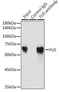 Immunoprecipitation analysis of 300µg extracts of Jurkat cells using 3µg of Anti-TLS / FUS Antibody (A9768). This Western blot was performed on the immunoprecipitate using Anti-TLS / FUS Antibody (A9768) at a dilution of 1:2000.