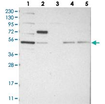 Anti-CDCA7L Rabbit Polyclonal Antibody