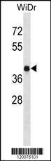 Anti-GNRHR Rabbit Polyclonal Antibody