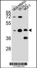 Anti-KBTBD13 Rabbit Polyclonal Antibody (APC (Allophycocyanin))