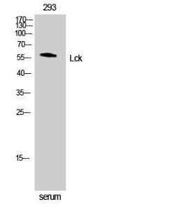 Western blot analysis of NIH 3T3 cells using Anti-Lck Antibody