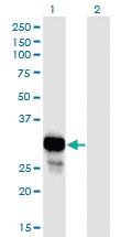 Anti-PNP Mouse Monoclonal Antibody [clone: 6E5]