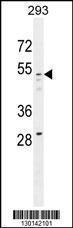 Anti-GOG8A Rabbit Polyclonal Antibody (AP (Alkaline Phosphatase))