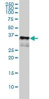 Anti-CD1A Mouse Monoclonal Antibody [clone: M1-2-1B5]