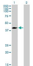 Anti-MVD Rabbit Polyclonal Antibody