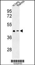 Anti-ACKR3 Rabbit Polyclonal Antibody (AP (Alkaline Phosphatase))