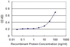 Anti-CD1A Mouse Monoclonal Antibody [clone: M1-2-1B5]