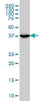 Anti-MVD Mouse Monoclonal Antibody [clone: 2A7]