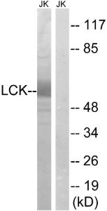 Western blot analysis of lysates from Jurkat cells using Anti-Lck Antibody. The right hand lane represents a negative control, where the antibody is blocked by the immunising peptide