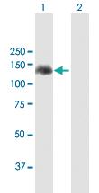 Anti-APAF1 Mouse Polyclonal Antibody