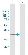 Anti-LYSMD4 Mouse Polyclonal Antibody