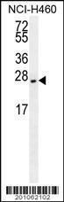 Anti-EIF4E2 Mouse Monoclonal Antibody (HRP (Horseradish Peroxidase)) [clone: 225CT3.1.3]