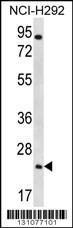 Anti-AQP5 Rabbit Polyclonal Antibody (APC (Allophycocyanin))