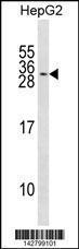 Anti-KCNMB2 Rabbit Polyclonal Antibody