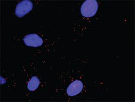 Anti-RHOA + DAAM1 Antibody Pair