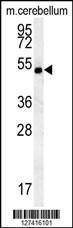 Anti-hCG_2039146 Rabbit Polyclonal Antibody (PE (Phycoerythrin))