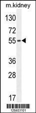 Anti-FBXO39 Rabbit Polyclonal Antibody (HRP (Horseradish Peroxidase))