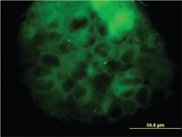 Anti-MVD Mouse Monoclonal Antibody [clone: 2A7]