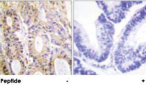 Anti-SMAD3 Rabbit Polyclonal Antibody