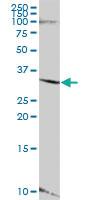 Anti-LYSMD4 Mouse Polyclonal Antibody