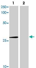 Anti-ABCC10 Mouse Monoclonal Antibody [clone: C1.7F12.3G11]