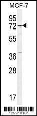 Anti-OTOP3 Rabbit Polyclonal Antibody (PE (Phycoerythrin))